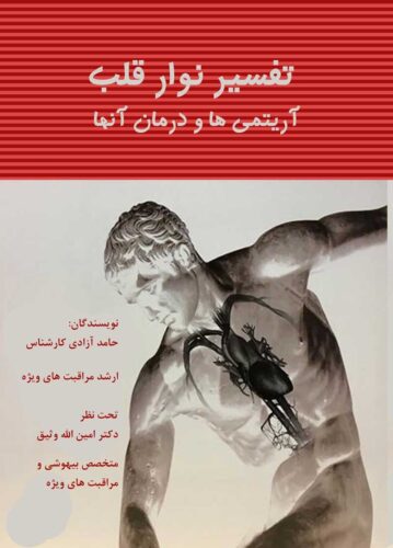 تفسیر نوار قلب